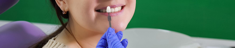 dentist-with-tooth-color-samples-is-choosing-shade-women-patient-teeth-dental-clinic-young-woman-portrait-close-up